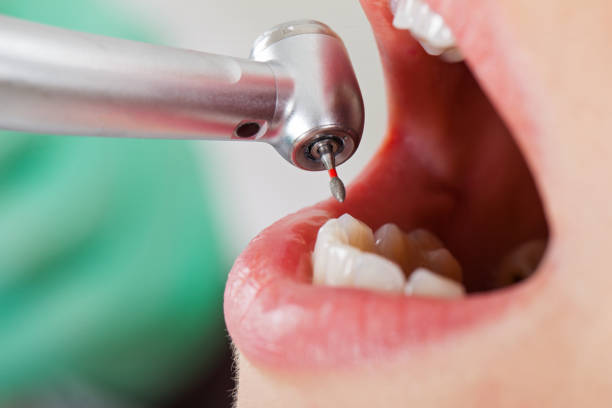 Best After-Hours Dental Trauma Care in Foothill Farms, CA